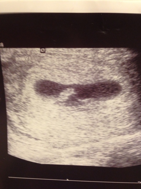 Although just a (cute) blob, we did get to see the heartbeat that day. It was so fun!